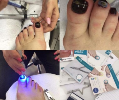 NOVO U ALUNI – 3TO PROTEZE